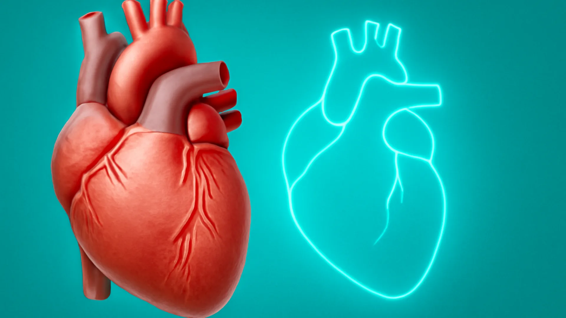 Kardiomiopati Takotsubo (Stress-Induced Cardiomyopathy)