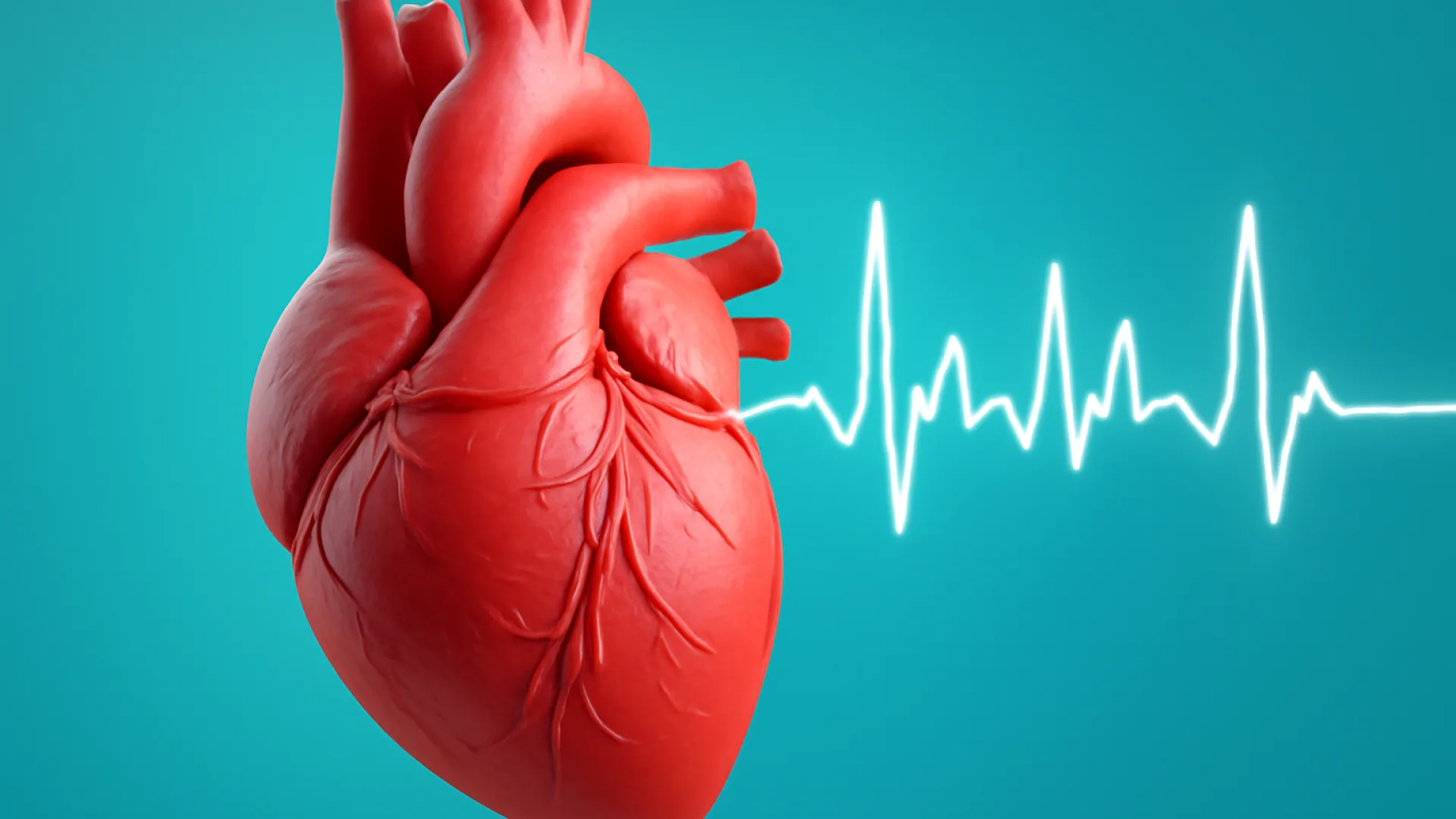 Atrial Fibrilasi (AF)
