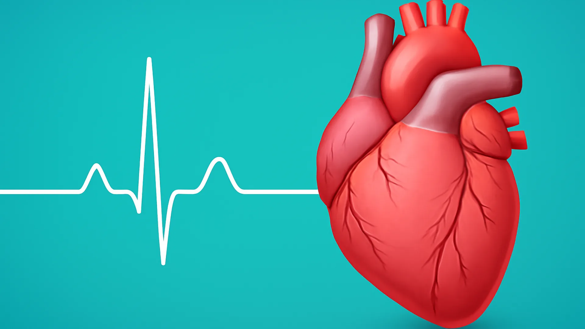 Ekstrasistol Atrial (PAC) & Ventrikel (PVC)