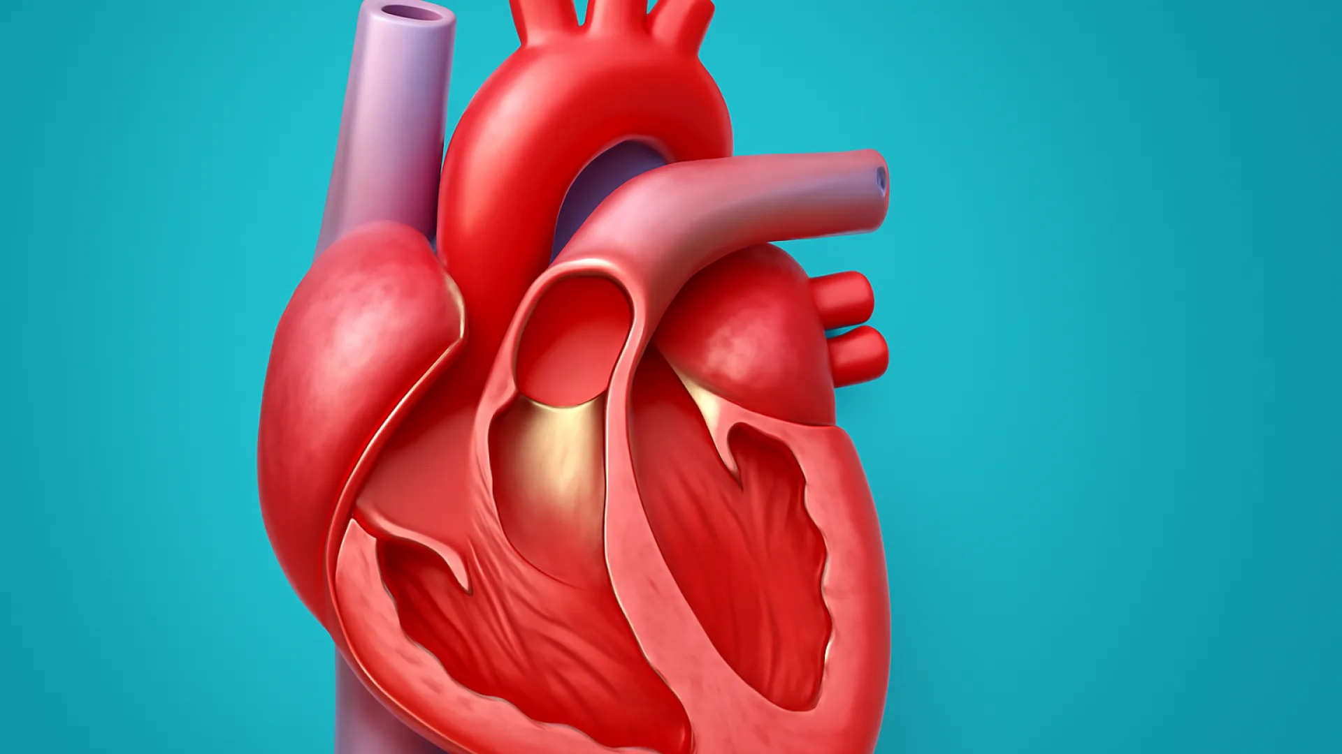 Stenosis Aorta