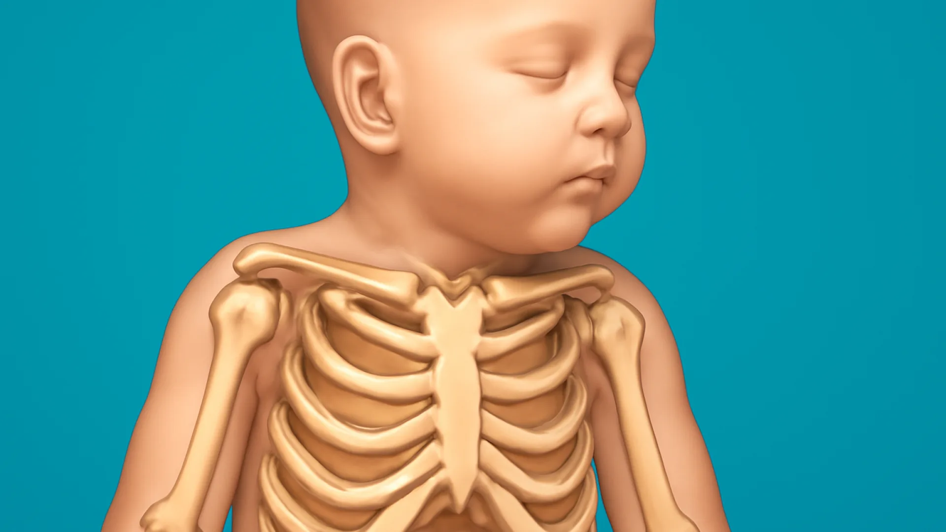 Kelainan Kongenital Muskuloskeletal