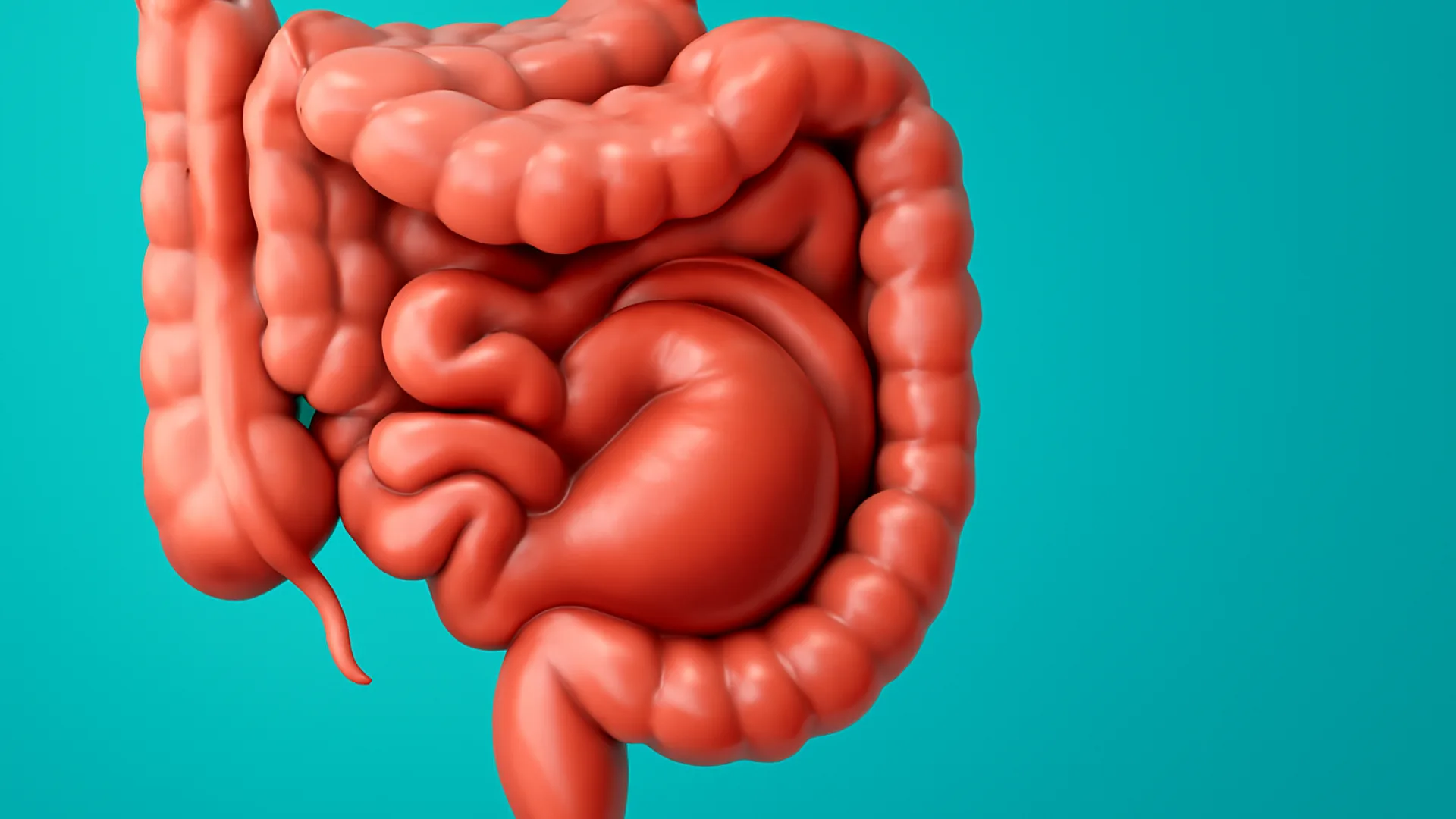 Ileus Obstruktif