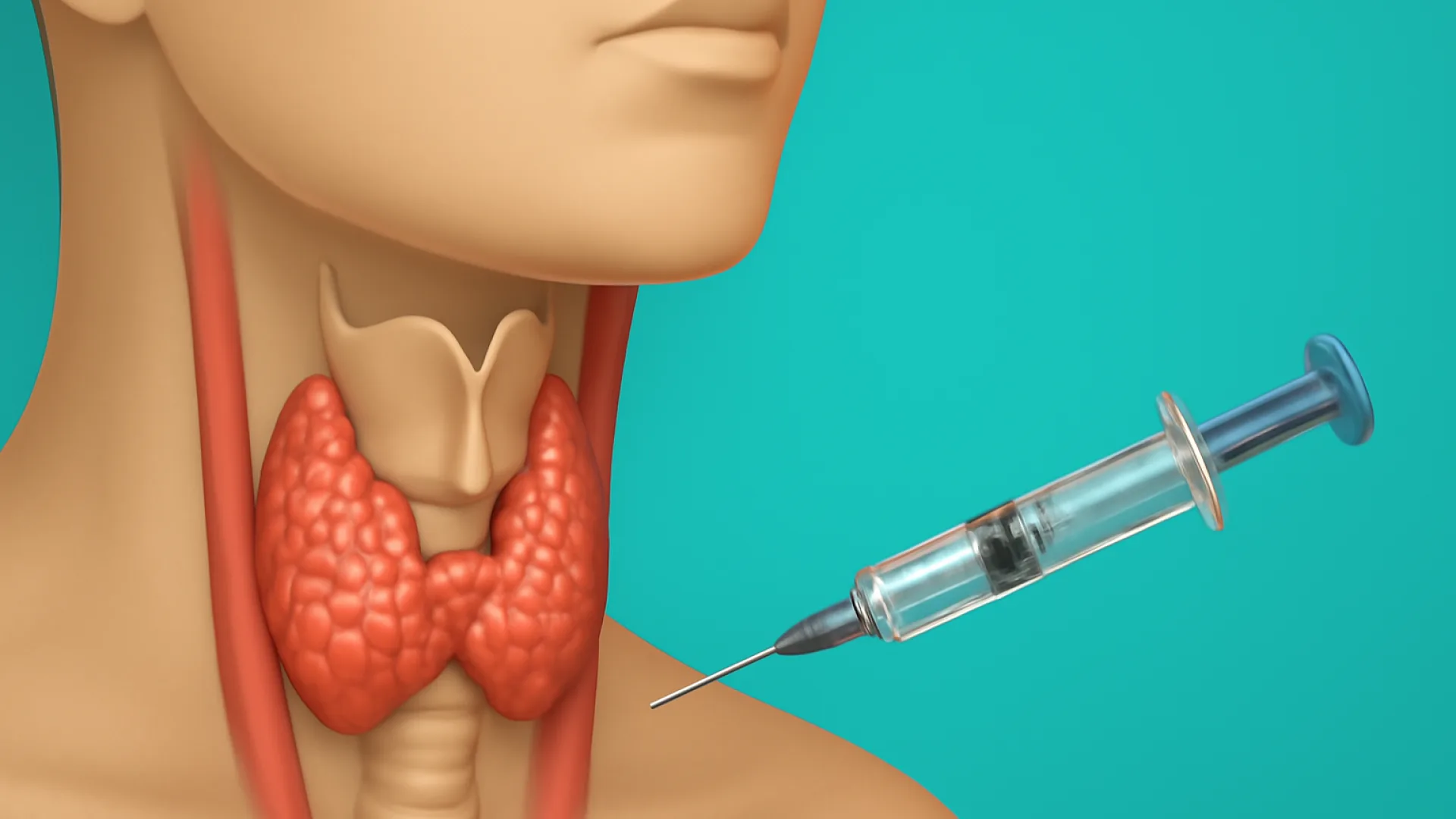 Gangguan Tiroid: Hipotiroidisme dan Hipertiroidisme