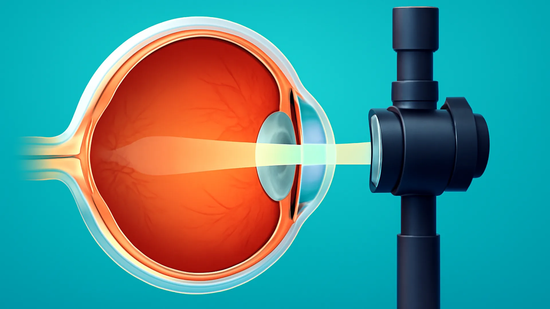 Kelainan Refraksi: Hipermetropi, Astigmatisme, Presbiopia