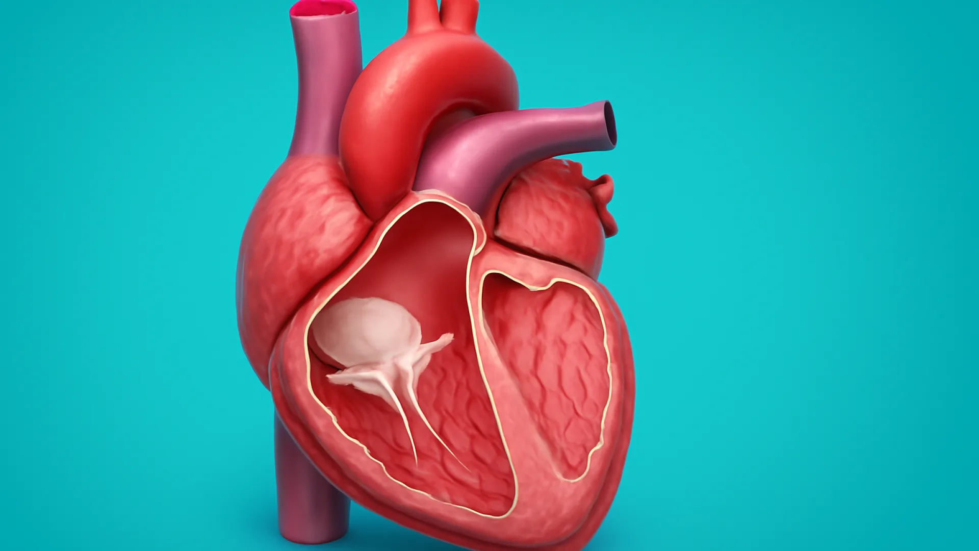 Stenosis Katup Trikuspid dan Pulmonal