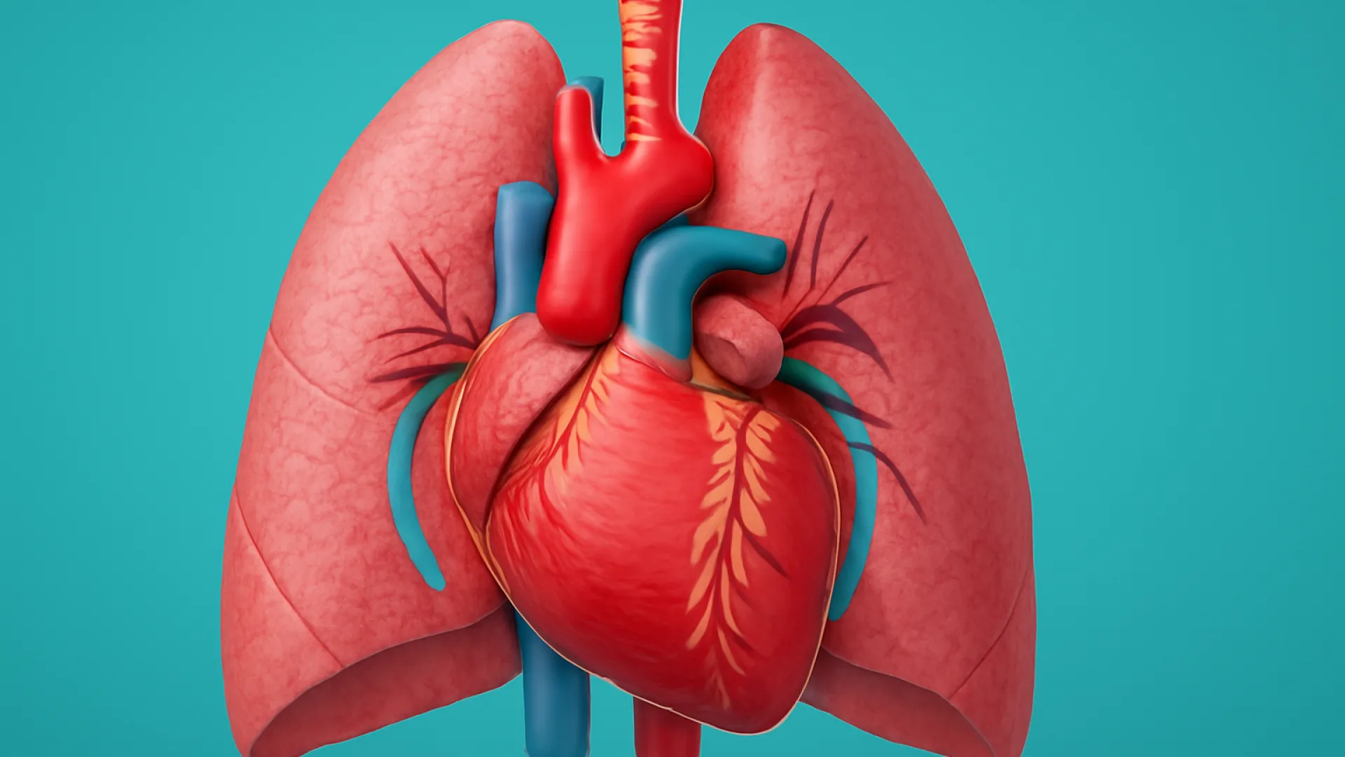 Hipertensi Pulmonal: Klasifikasi WHO