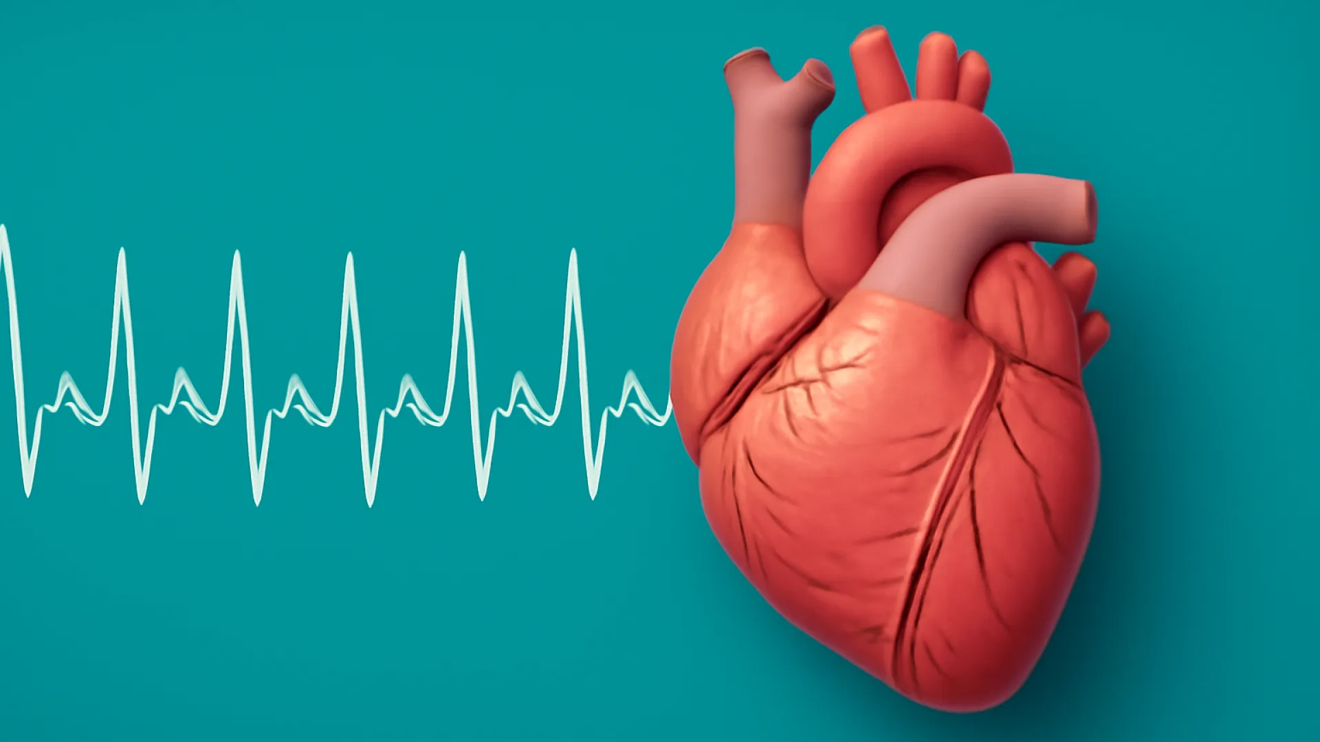 Atrial Flutter