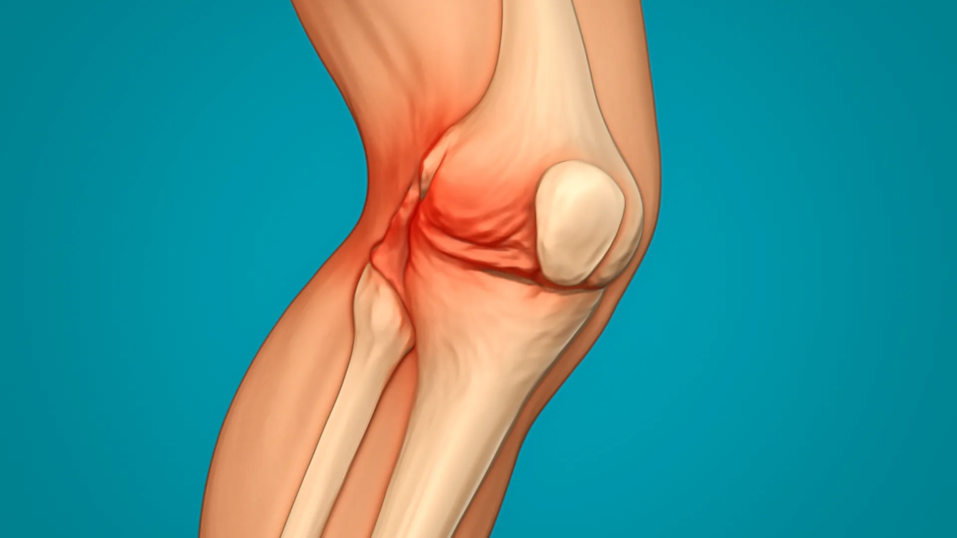 Cedera Lutut dan Ankle: Panduan Diagnosis Cepat