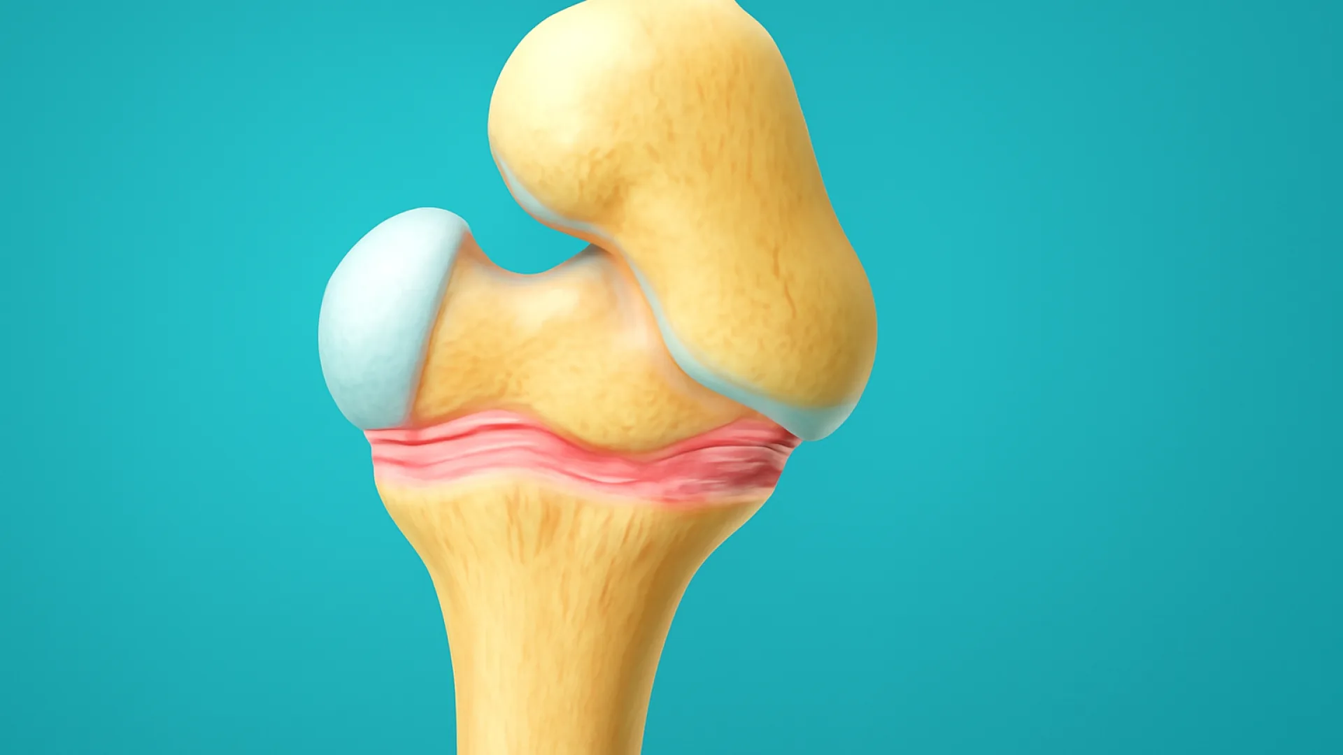 Gangguan Pertumbuhan Tulang: Displasia Skelet & Osteogenesis Imperfecta