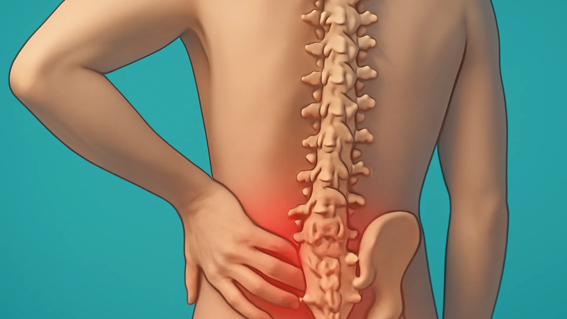 Lupus Eritematosus Sistemik (SLE) dan Spondyloartropati
