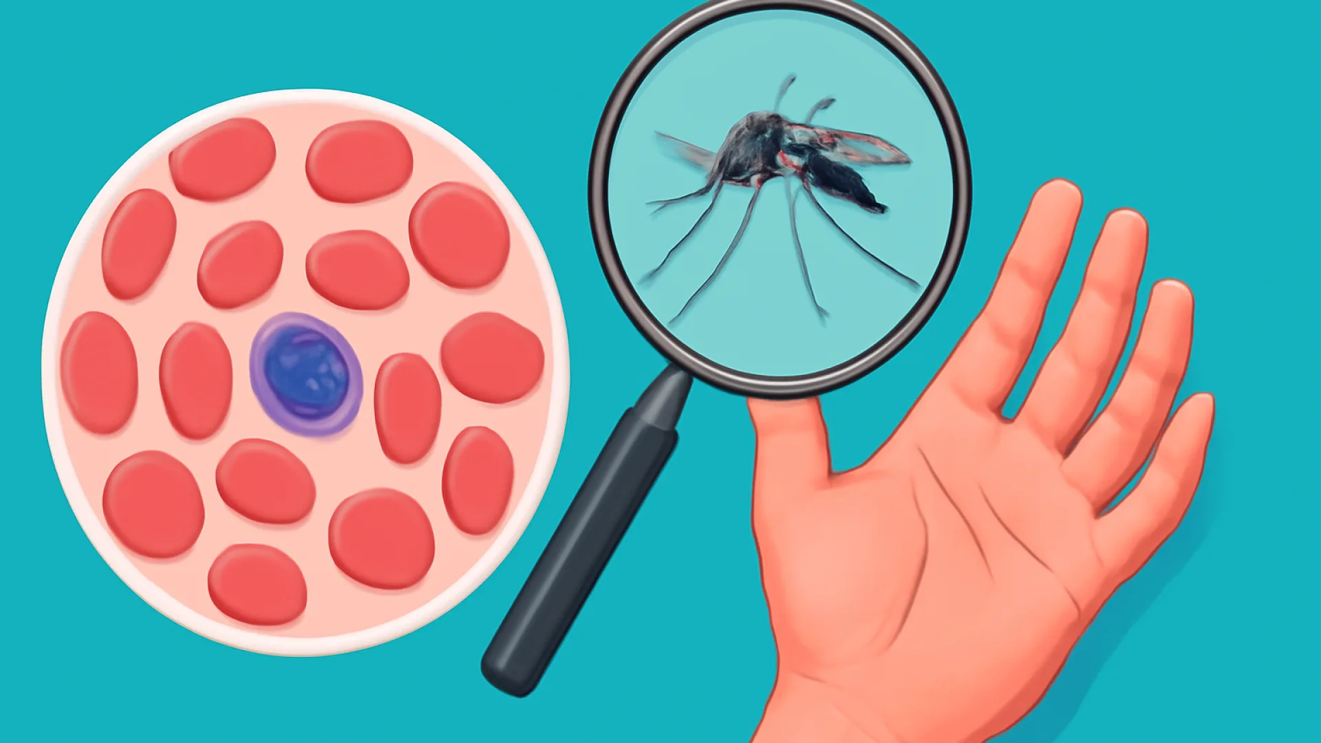 Malaria