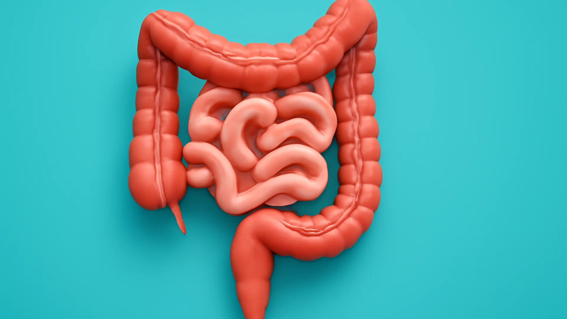 Malrotasi Volvulus Intestinum