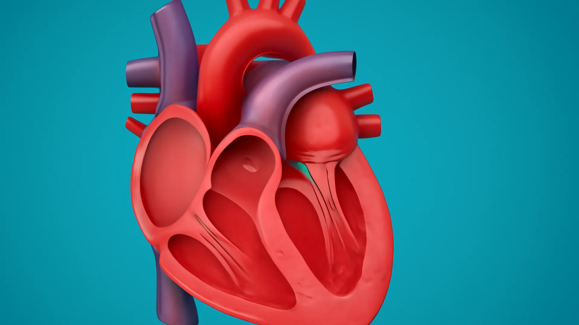 Regurgitasi Mitral