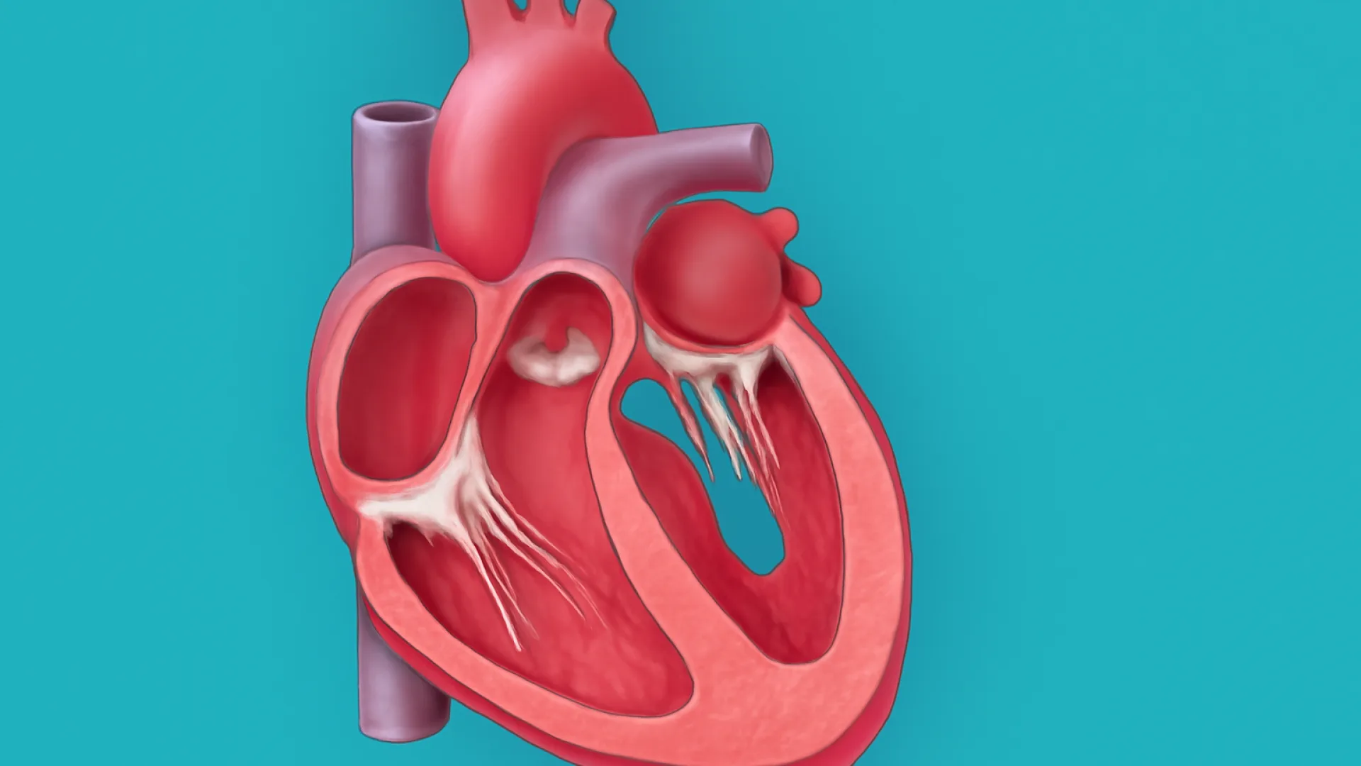 Regurgitasi Trikuspid dan Pulmonal