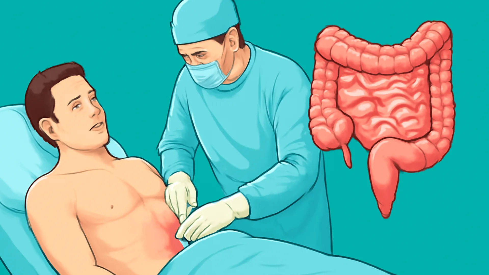 Akut Abdomen: Pendekatan Klinis & Diagnosis Cepat